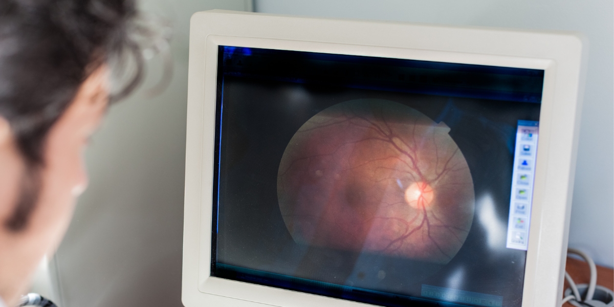 médico oftalmologista analisando um caso de descolamento de retina